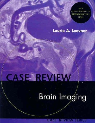 Brain Imaging