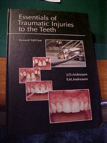Essentials of Traumatic Injuries to the Teeth: A Step-by-Step Treatment Guide