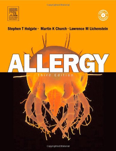 Allergy: Expert Consult Online and Print