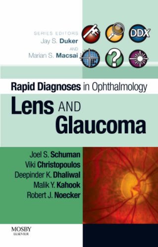 Rapid Diagnosis in Ophthalmology Series
