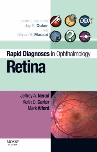Rapid Diagnosis in Ophthalmology Series: Retina (Rapid Diagnoses in Ophthalmology)