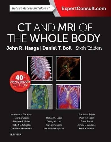 CT and MRI of the Whole Body, 2-Volume Set
