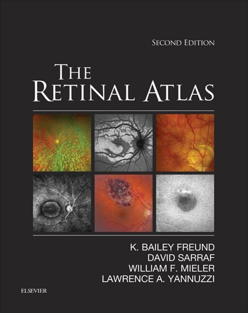 The Retinal Atlas E-Book