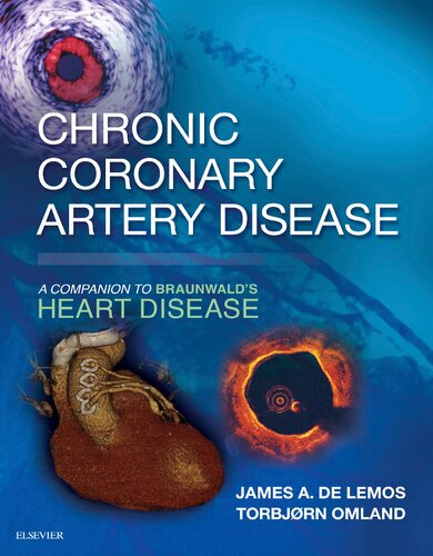 Chronic Coronary Artery Disease