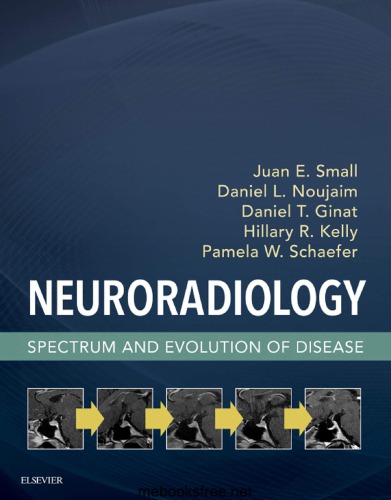 Neuroradiology : spectrum and evolution of disease