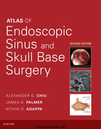 Atlas of Endoscopic Sinus and Skull Base Surgery E-Book