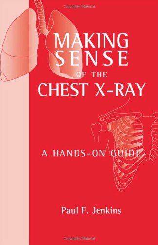 Making Sense of the Chest X-Ray