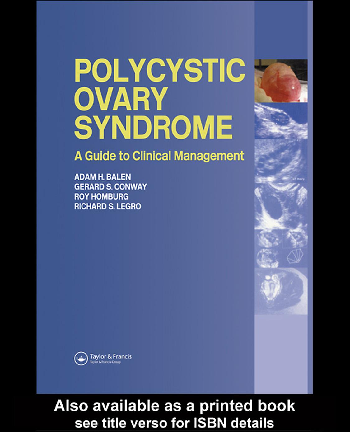 Polycystic Ovary Syndrome