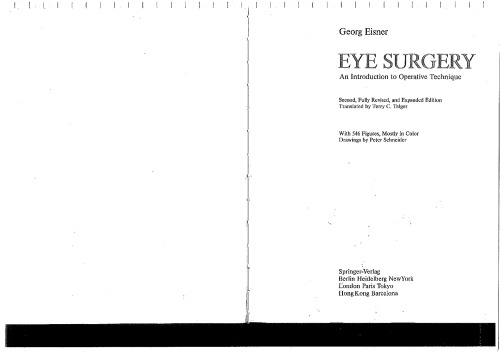 Eye Surgery