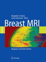 Breast MRI : Diagnosis and Intervention