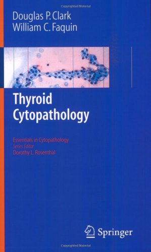 Thyroid Cytopathology