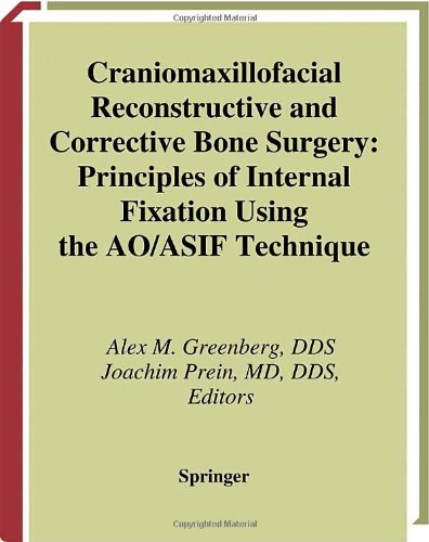 Craniomaxillofacial Reconstructive and Corrective Bone Surgery: Principles of Internal Fixation Using AO/ASIF Technique