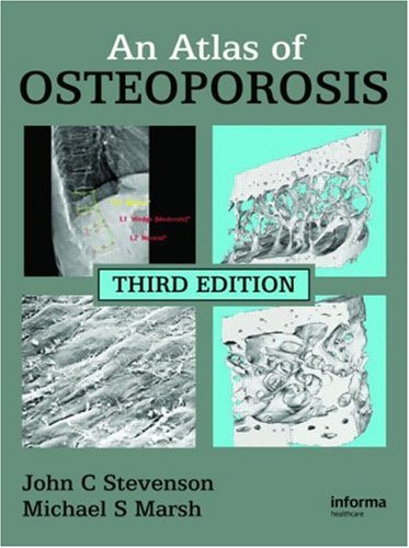 An Atlas of Osteoporosis (Encyclopedia of Visual Medicine)