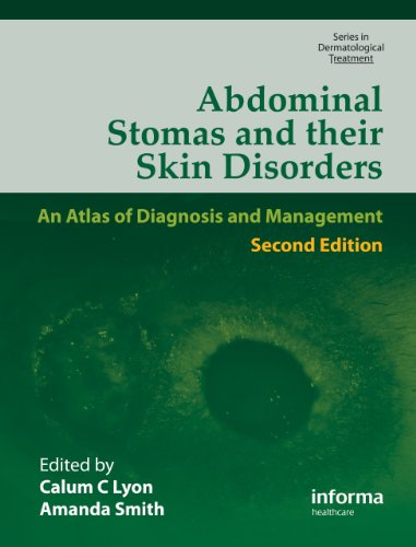 Abdominal Stomas And Their Skin Disorders, Second Edition   Dansac Edition