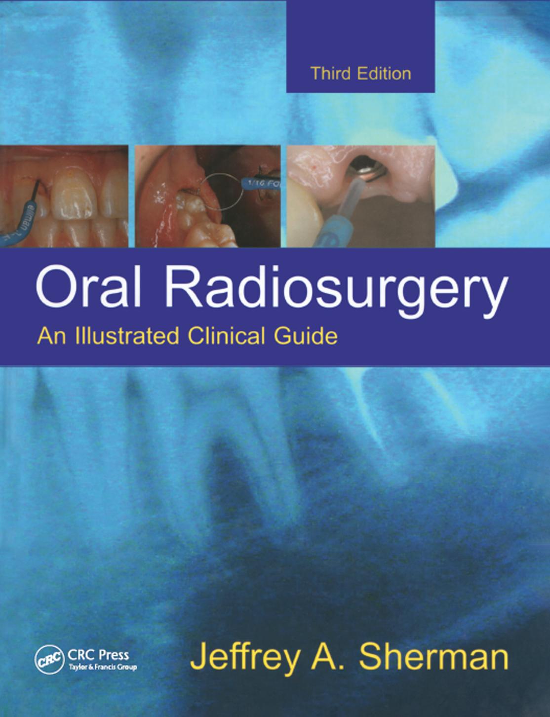 Oral radiosurgery : an illustrated clinical guide