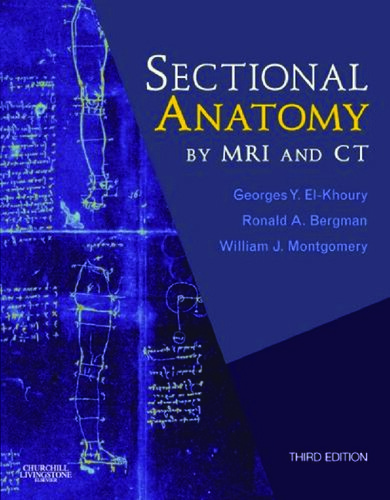 Sectional Anatomy by MRI and CT with Website