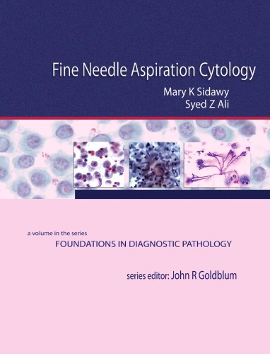 Fine Needle Aspiration Cytology