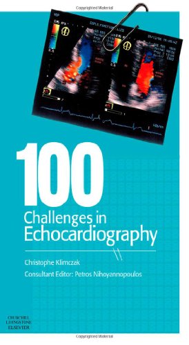 100 Challenges in Echocardiography