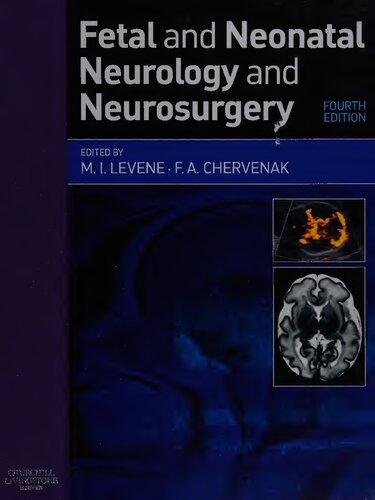 Fetal and Neonatal Neurology and Neurosurgery