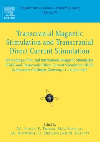 Transcranial Magnetic Stimulation, 56