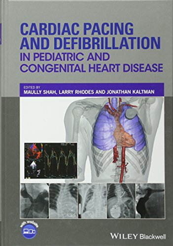 Cardiac Pacing and Defibrillation in Pediatric and Congenital Heart Disease