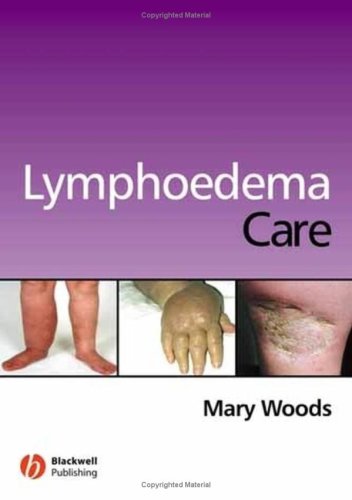 Lymphoedema care