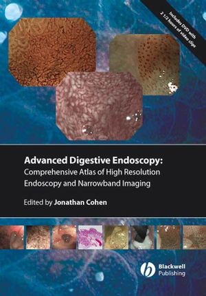 Comprehensive atlas of high resolution endoscopy and narrow band imaging