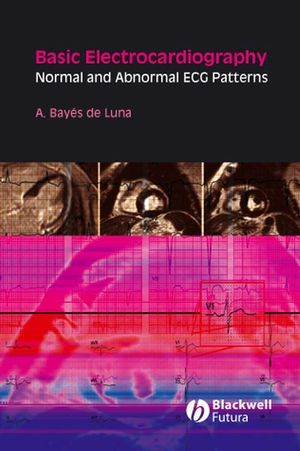 Basic electrocardiography : normal and abnormal ECG patterns