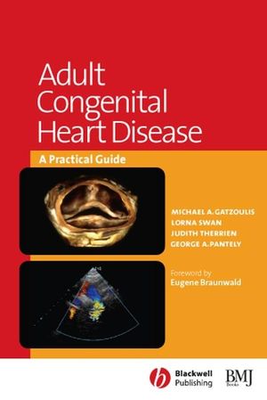 Adult congenital heart disease : a practical guide