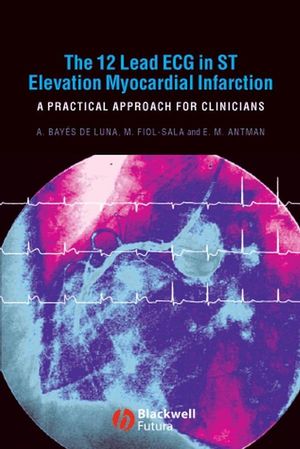 The 12-lead ECG in ST elevation myocardial infarction : a practical approach for clinicians