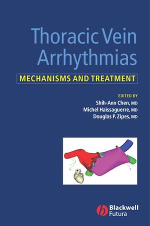 Thoracic vein arrhythmias : mechanisms and treatment