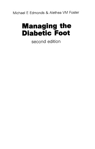 Managing the diabetic foot