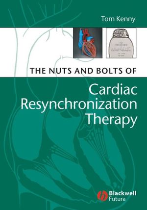 The nuts and bolts of cardiac resynchronization therapy