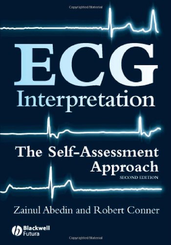 ECG Interpretation