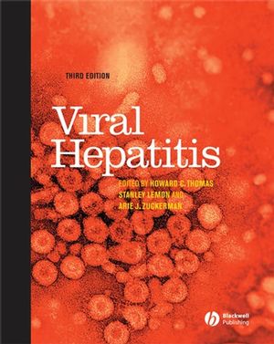 Viral hepatitis