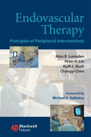 Endovascular therapy : principles of peripheral interventions