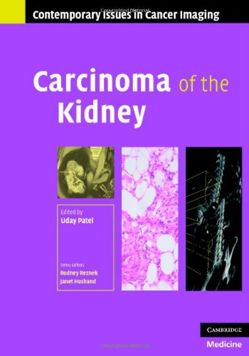 Carcinoma of the Kidney