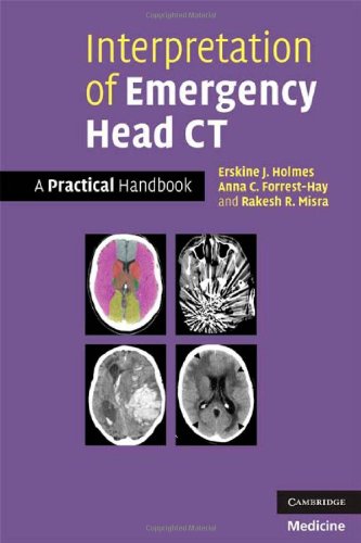 Interpretation of Emergency Head CT