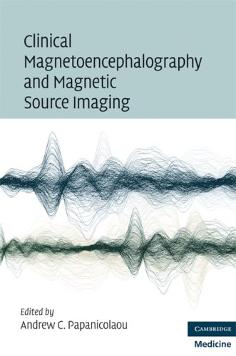 Clinical Magnetoencephalography and Magnetic Source Imaging