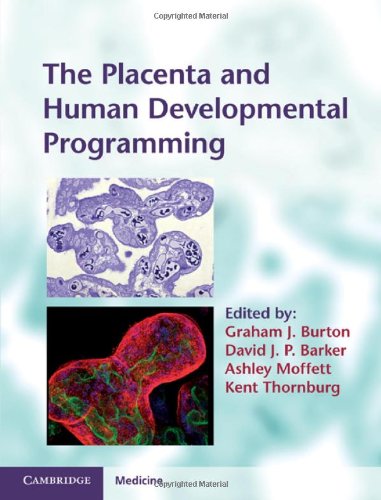 The Placenta and Human Developmental Programming (Cambridge Medicine (Hardcover))