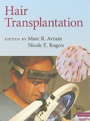Hair Transplantation (Cambridge Medicine (Hardcover))