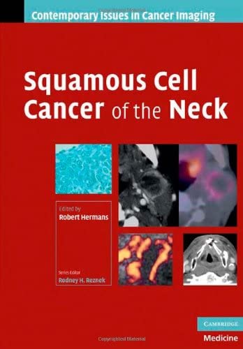 Squamous Cell Cancer of the Neck (Contemporary Issues in Cancer Imaging)