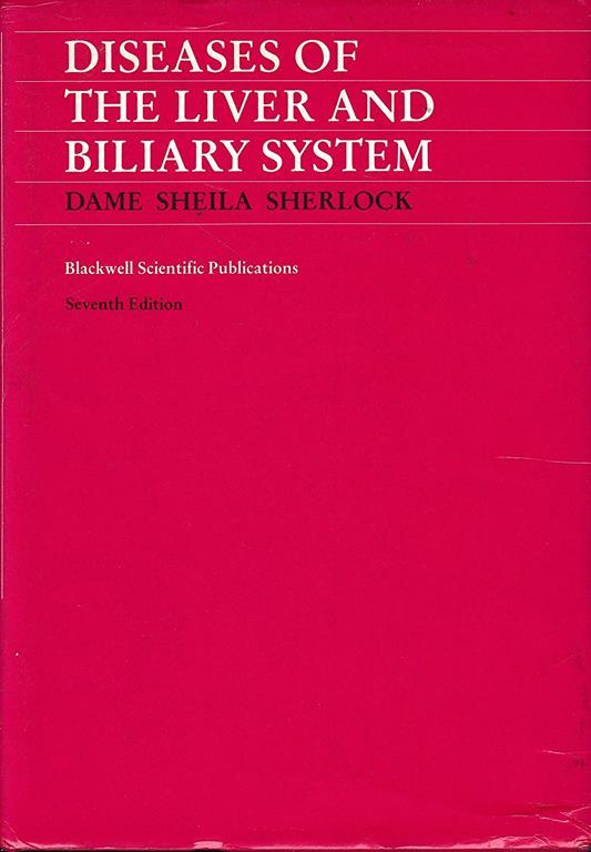 Diseases of the liver and biliary system