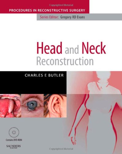 Head and Neck Reconstruction [With Dvdrom]