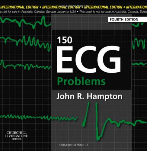 150 ECG Problems, International Edition