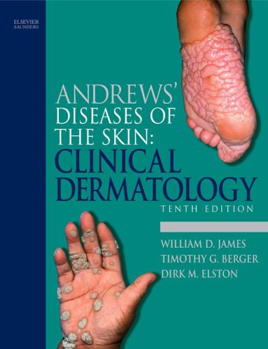 Andrews' Diseases of the Skin