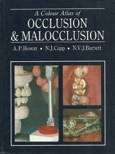 A Colour Atlas Of Occlusion &amp; Malocclusion