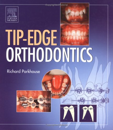 The Tip-Edge Orthodontic System