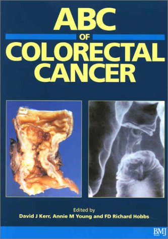 ABC of Colorectal Cancer (ABC Series)