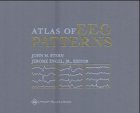 Atlas of EEG Patterns